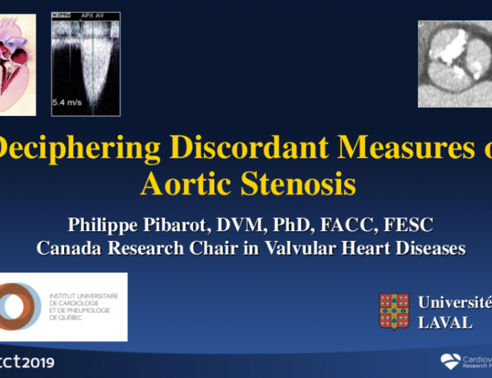 Deciphering Discordant Measures of Aortic Stenosis
