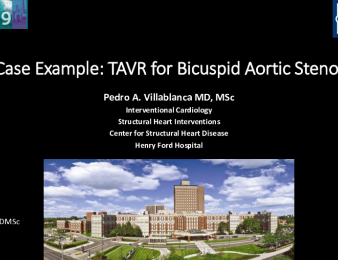 Case Example: TAVR for Bicuspid Aortic Stenosis
