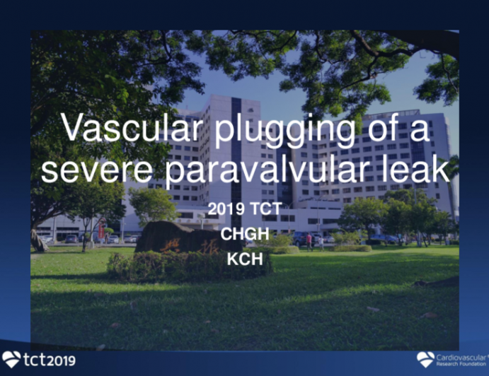 Case 7 (From Taiwan): Vascular Plugging of a Severe Paravalvular Leak