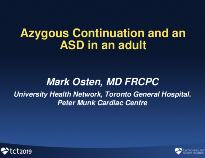 An Adult With Azygous Continuation and an ASD