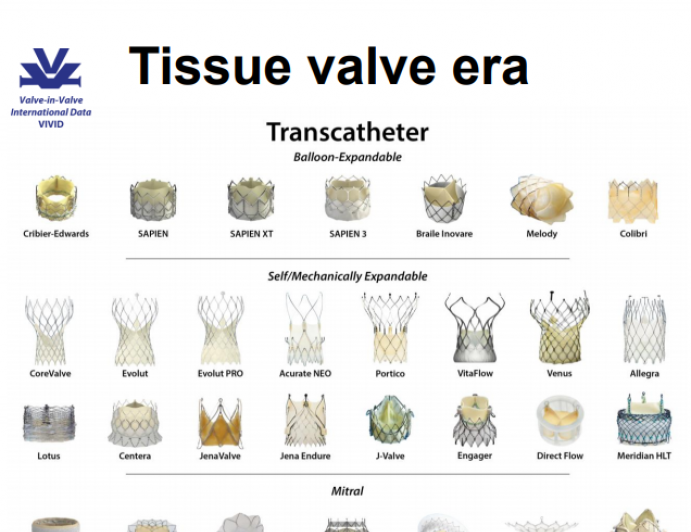 Failed Aortic Valve Bioprostheses: Valve-in-Valve or Redo-SAVR?