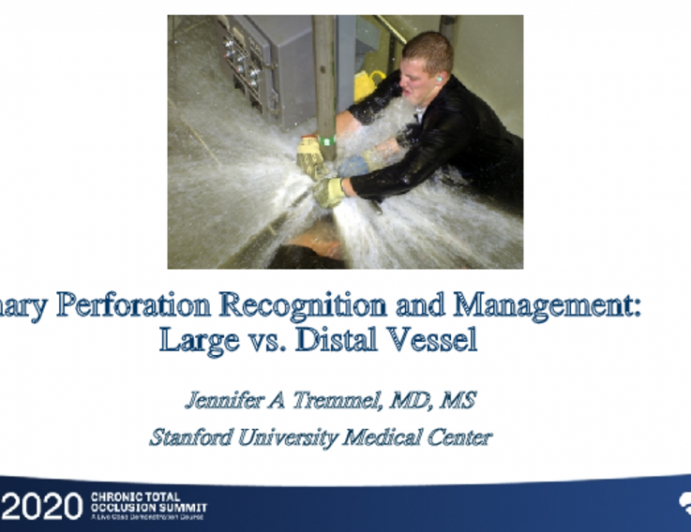 Coronary Perforation Recognition and Management: Large vs. Distal Vessel