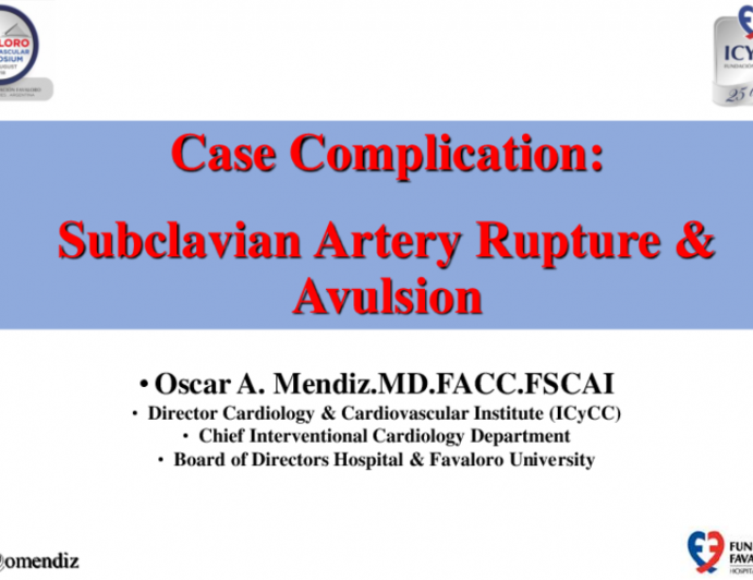Case Complication: Subclavian Artery Rupture & Avulsion