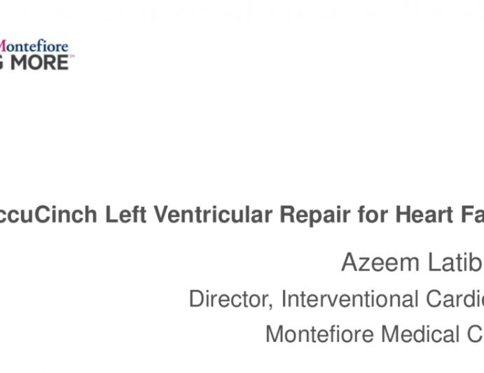 AccuCinch Left Ventricular Repair for Heart Failure