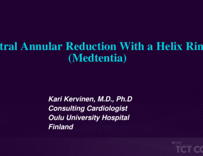 Mitral Annular Reduction With a Helix Ring (Medtentia)