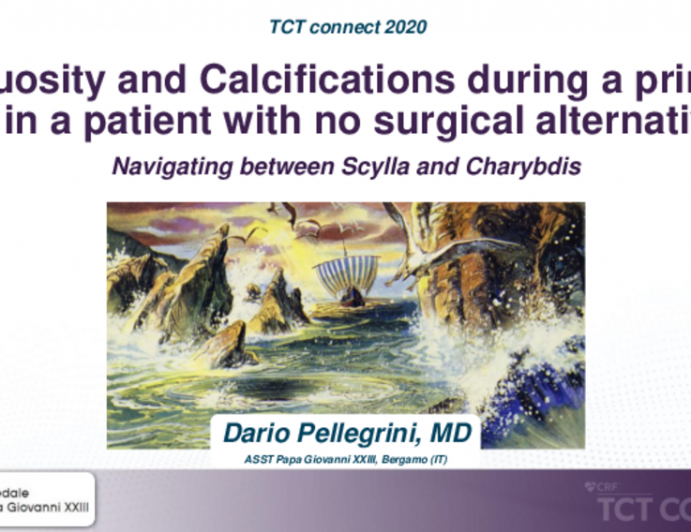 TCT 591: Tortuosity and Calcifications During a Primary PCI in a Patient With no Surgical Alternatives: Navigating Between Scylla and Charybdis