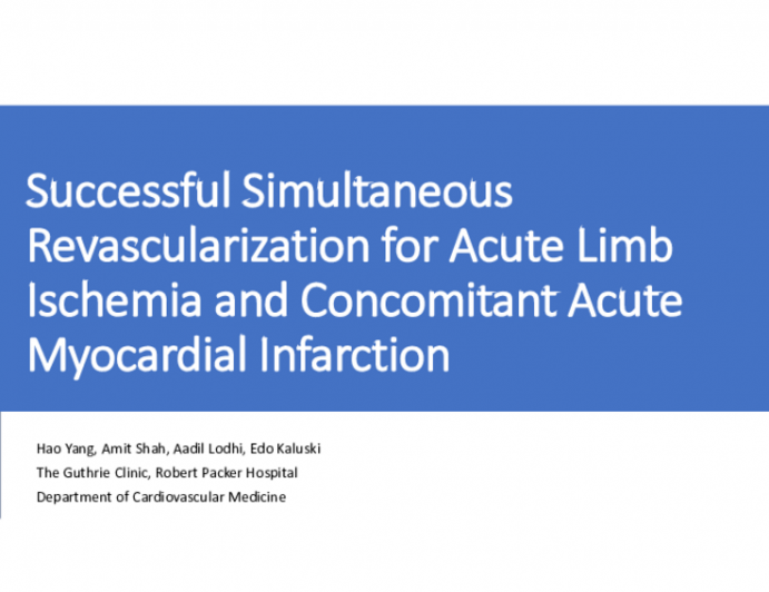 TCT 633: Successful Simultaneous Revascularization of Acute Limb Ischemia and Concomitant Acute Myocardial Infarction