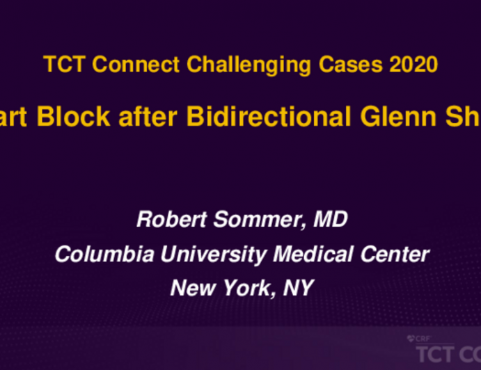TCT 513: Third Degree Heart Block After Bidirectional Glenn Shunt
