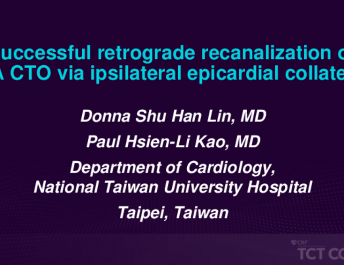 TCT 571: Successful Retrograde Recanalization of RCA CTO via Ipsilateral Epicardial Collaterals