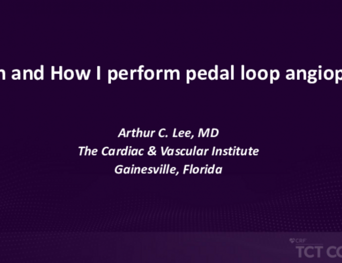 When and How I Perform Pedal Loop Angioplasty