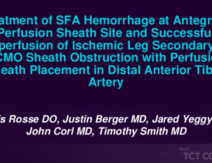 TCT 648: Treatment of a SFA Hemorrhage at Antegrade Perfusion Sheath Site and Successful Reperfusion of an Ischemic Leg Secondary to ECMO Sheath Obstruction with Perfusion Sheath Placement in the Distal Anterior Tibial Artery