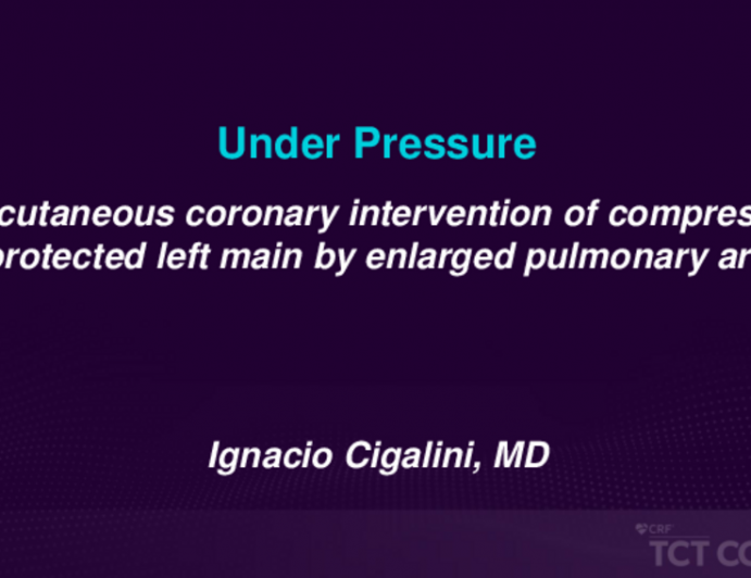 TCT 584: Under Pressure: Percutaneous Coronary Intervention of Compressed Unprotected Left Main by Enlarged Pulmonary Artery