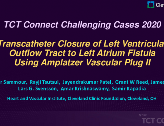 TCT 557: Transcatheter Closure of Left Ventricular Outflow Tract to Left Atrium Fistula Using Amplatzer Vascular Plug II
