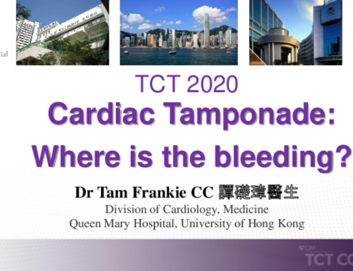 TCT 526: Cardiac Tamponade: Where is the Bleeding?