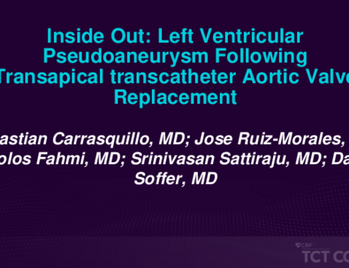 TCT 679: Inside Out: Left Ventricular Aneurysm Following Transcatheter Aortic Valve Replacement.
