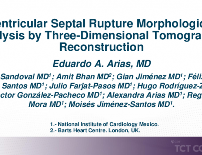 TCT 439: Ventricular Septal Rupture Morphological Analysis by Three-Dimensional Tomographic Reconstruction
