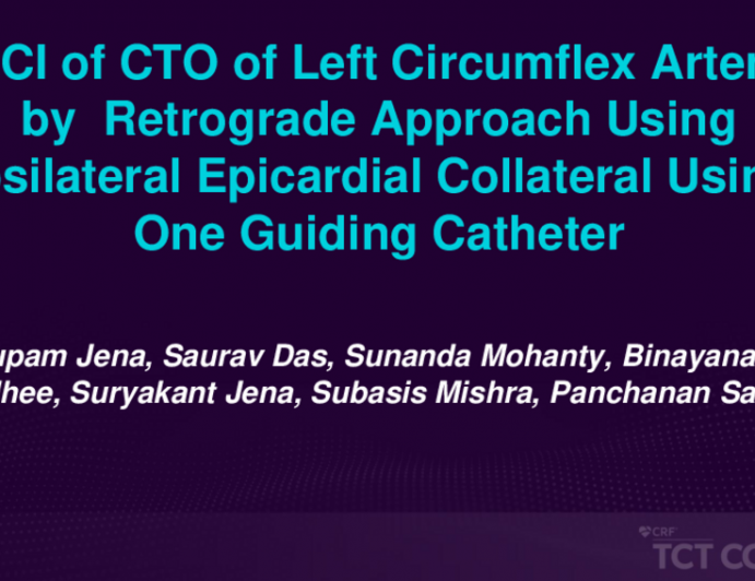 TCT 556: PCI of CTO of Left Circumflex Artery by Retrograde Approach Through Ipsilateral Epicardial Collateral Using One Guiding Catheter