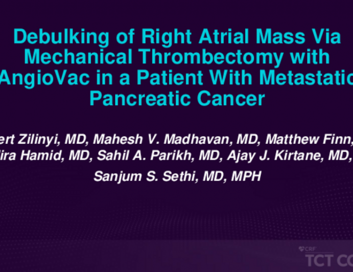 TCT 518: Debulking of Right Atrial Mass Via Mechanical Thrombectomy With Angiovac in a Patient With Metastatic Pancreatic Cancer