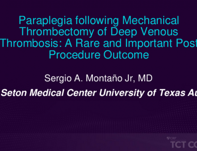 TCT 516: Paraplegia Following Mechanical Thrombectomy of Deep Venous Thrombosis: A Rare and Important Post Procedure Outcome