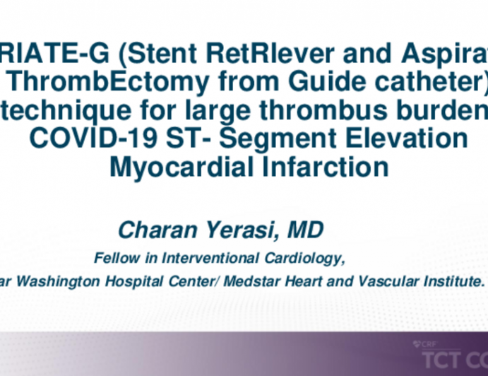 TCT 552: “STRIATE-G (Stent RetRIever and Aspiration ThrombEctomy From Guide Catheter)” Technique for Large Thrombus Burden/ COVID-19 ST- Segment Elevation Myocardial Infarction