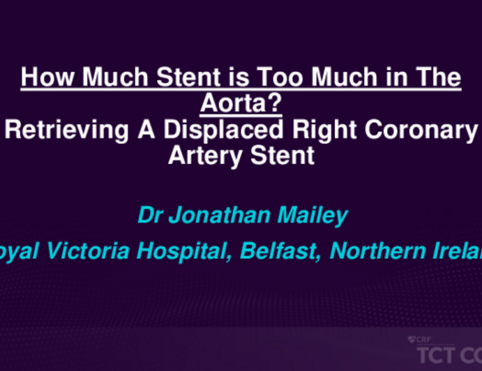 TCT 546: Too Much Stent In The Aorta? Retrieving A Displaced Coronary Artery Stent