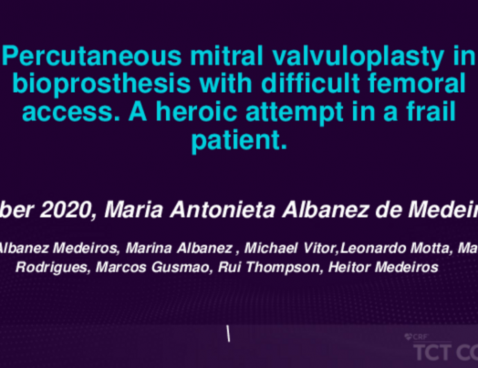 TCT 604: Percutaneous Mitral Valvuloplasty in Bioprosthesis With a Femoral Access Disease