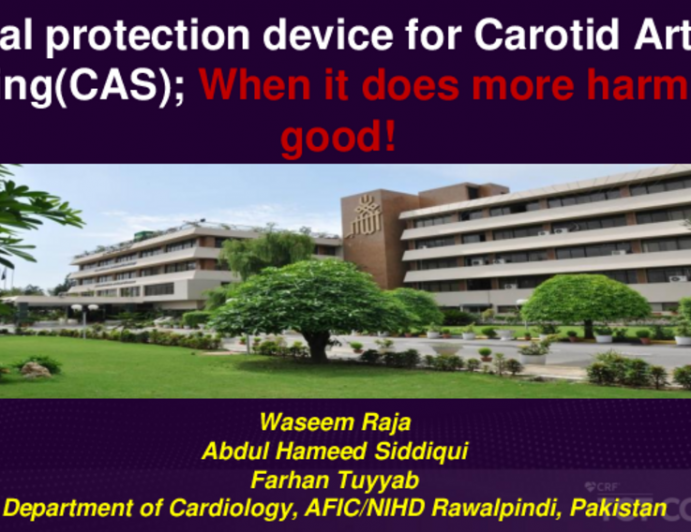 TCT 576: Distal Protection Device for Carotid Artery Stenting(CAS); When it Does More Harm Than Good!