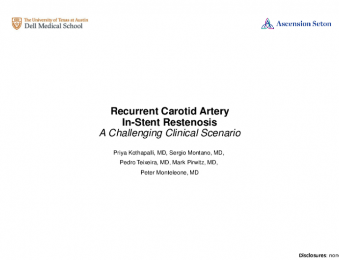 TCT 694: Recurrent Carotid Artery In-Stent Restenosis - A Challenging Clinical Scenario