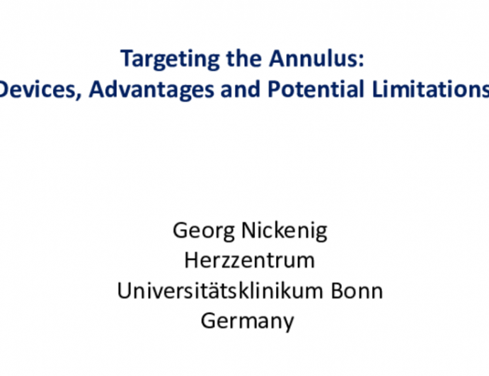 FMR: Targeting the Annulus: Devices, Advantages, and Potential Limitations