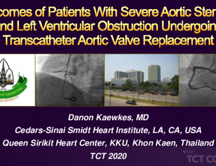 TCT 126: Outcomes of Patients With Severe Aortic Stenosis and Left Ventricular Obstruction Undergoing Transcatheter Aortic Valve Replacement