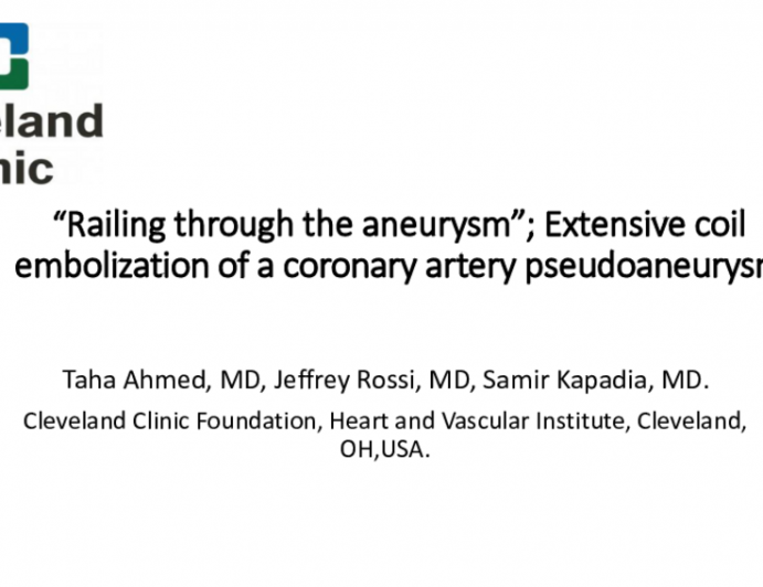 TCT 563: “Railing Through the Aneurysm”; Extensive Coil Embolization of a Coronary Artery Pseudoaneurysm