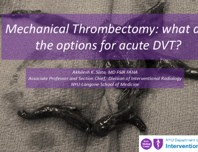 Mechanical Thrombectomy: what are the options for acute DVT?