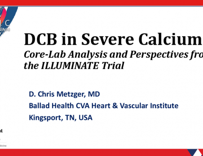 DCB in Severe Calcium: Core-Lab Analysis and Perspectives from the ILLUMINATE Trial