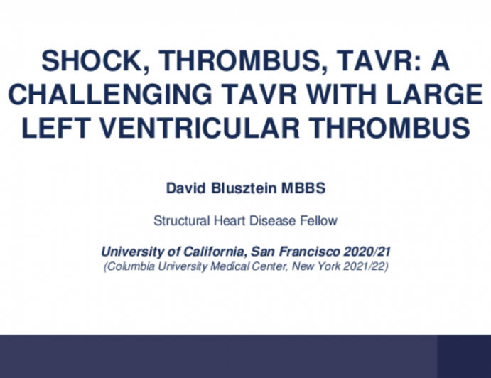 Shock, Thrombus, TAVR: A Challenging TAVR With Large Left Ventricular Thrombus