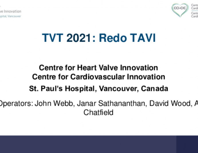 MASTER CLASS #1: Advanced Bioprosthetic Valve Failure Treated With TAVR