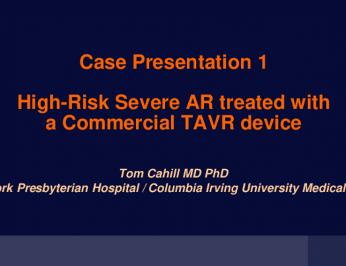 Case Presentation 1: High-Risk Severe AR with Commercially-Approved TAVR