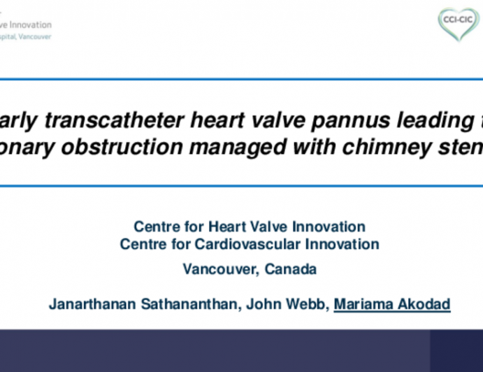 Early Transcatheter Heart Valve Pannus Leading to Coronary Obstruction Managed With Chimney Stenting