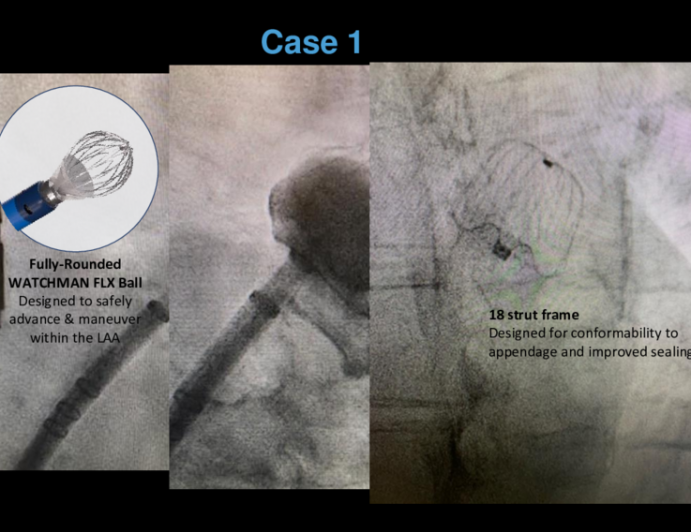 Case Conclusion