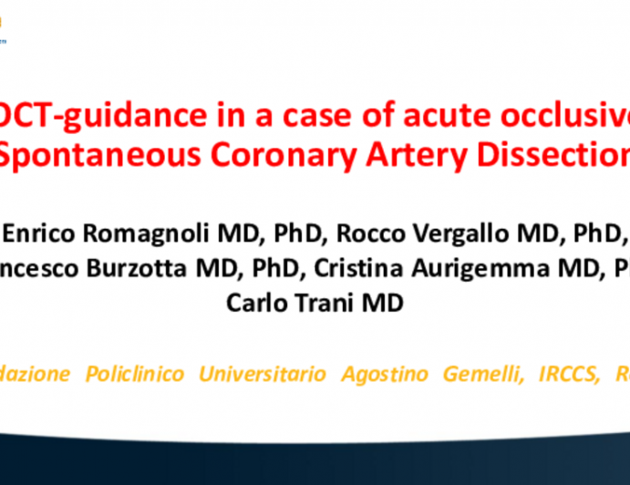 TCT 627: OCT-Guidance in a Case of Acute Occlusive Spontaneous Coronary Artery Dissection