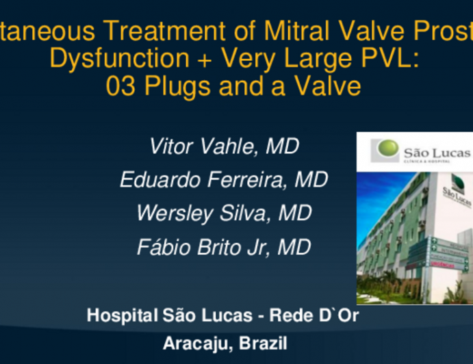 TCT 579: Percutaneous Treatment of Mitral Valve Prosthesis Dysfunction + Very Large PVL: 03 Plugs and a Valve