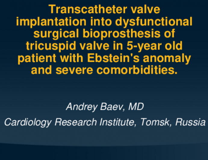 TCT 600: Transcatheter Valve Implantation Into Dysfunctional Surgical Bioprosthesis Of Tricuspid Valve in 5-Year Old Patient With Ebstein's Anomaly And Severe Comorbidities