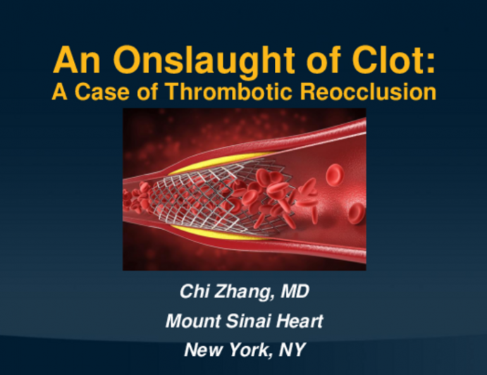 TCT 626: An Onslaught of Clot: A Case of Thrombotic Reocclusion