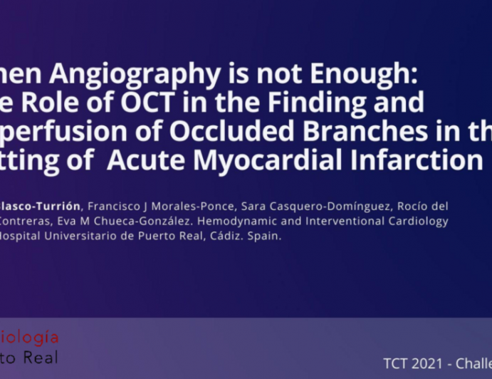 TCT 512: When Angiography is not Enough: The Role of Optical Coherence Tomography in the Finding and Reperfusion of Occluded Branches in the Setting of Acute Myocardial Infarction