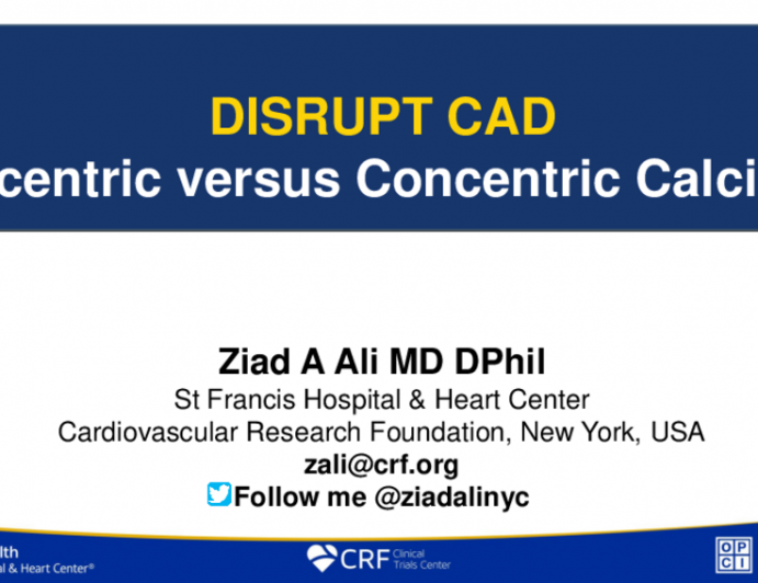 Disrupt CAD Pooled Eccentric vs Concentric Analysis