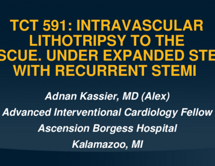 TCT 591: Intravascular Lithotripsy to the Rescue. Underexpanded Stent With Recurrent STEMIs 