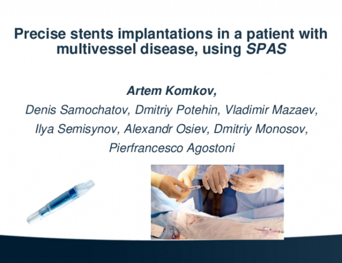 TCT 647: Precise stent implantations in a patient with multivessel disease, using SPAS