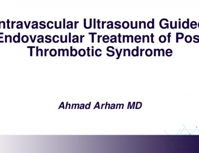 TCT 686: Intravascular Ultrasound Guided Endovascular Treatment of Post Thrombotic Syndrome