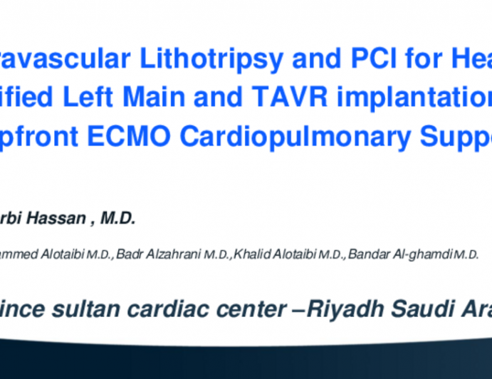 TCT 610: Intravascular Lithotripsy and Percutaneous Coronary Intervention for Heavily Calcified Left Main Stenosis and Transcatheter Aortic Valve Replacement Under Upfront Extracorporeal Membrane Oxygenation Cardiopulmonary Support