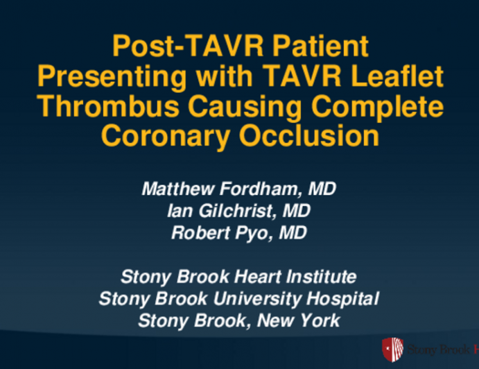 TCT 653: Post-TAVR Patient Presenting With TAVR Leaflet Thrombus Causing Complete Coronary Occlusion