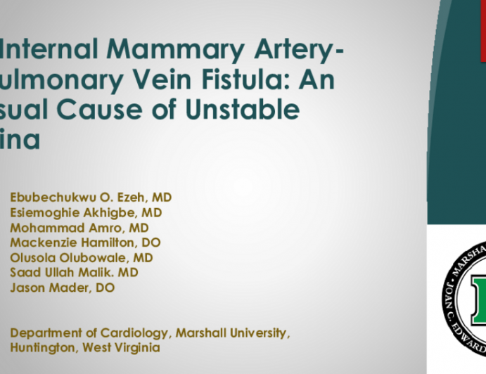 TCT 639: Left Internal Mammary Artery-to-Pulmonary Vein Fistula: An Unusual Cause of Unstable Angina